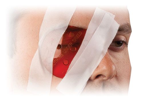 Polycarbonate Eye Shield (PES)