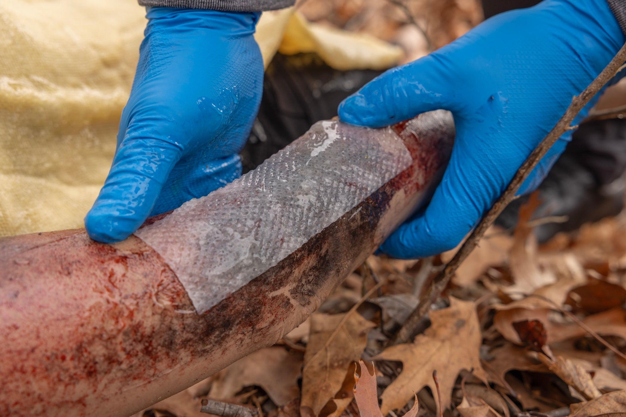 Water-Jel™ First Responder Burn Dressings