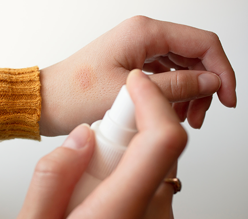 Antiseptic First Aid Spray 2oz Dynarex